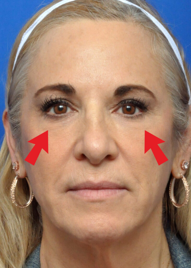 Plastic Surgery Before and After Pictures in Jacksonville, FL - Garcia Facial Plastic Surgery