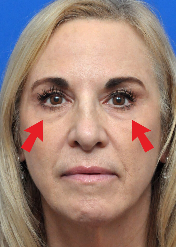 Plastic Surgery Before and After Pictures in Jacksonville, FL - Garcia Facial Plastic Surgery