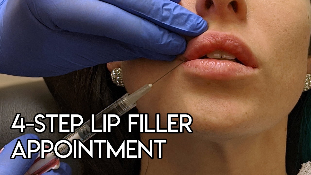 4-Step Lip Filler Appointment
