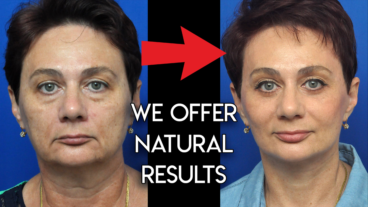 We Offer Natural Results