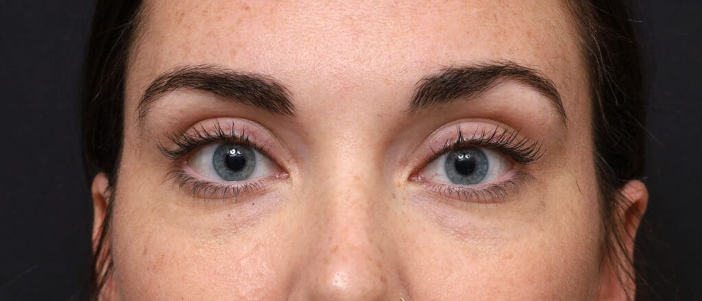 Plastic Surgery Before and After Pictures in Jacksonville, FL - Garcia Facial Plastic Surgery