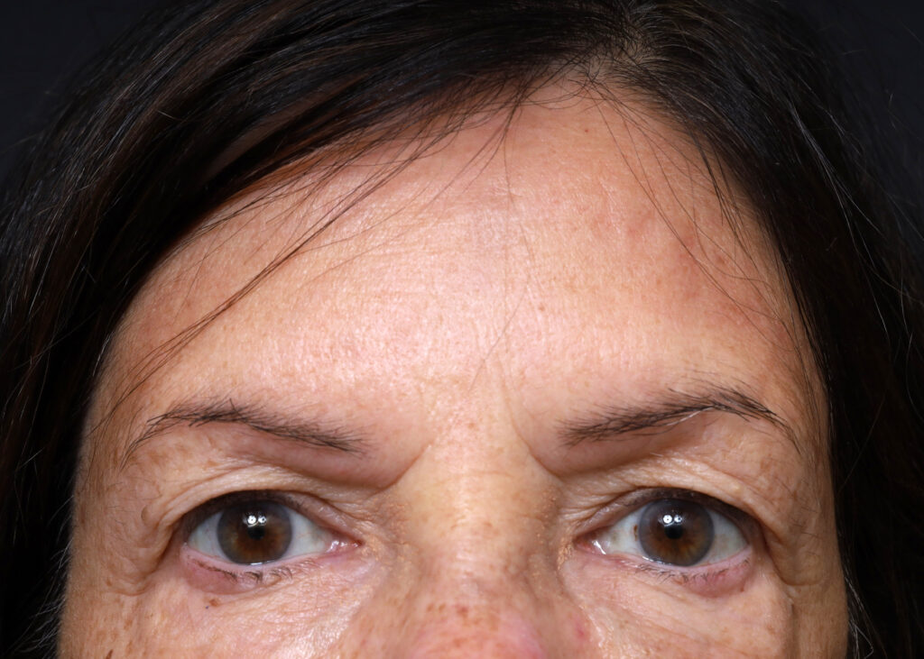 Plastic Surgery Before and After Pictures in Jacksonville, FL - Garcia Facial Plastic Surgery
