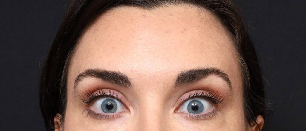Plastic Surgery Before and After Pictures in Jacksonville, FL - Garcia Facial Plastic Surgery
