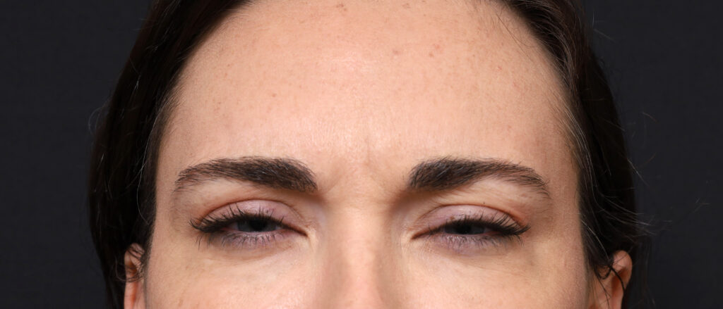 Plastic Surgery Before and After Pictures in Jacksonville, FL - Garcia Facial Plastic Surgery