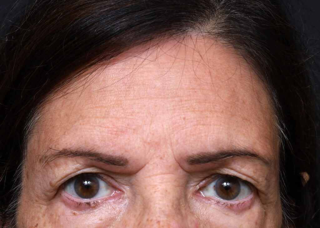 Plastic Surgery Before and After Pictures in Jacksonville, FL - Garcia Facial Plastic Surgery