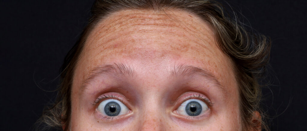 Plastic Surgery Before and After Pictures in Jacksonville, FL - Garcia Facial Plastic Surgery