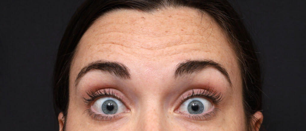 Plastic Surgery Before and After Pictures in Jacksonville, FL - Garcia Facial Plastic Surgery