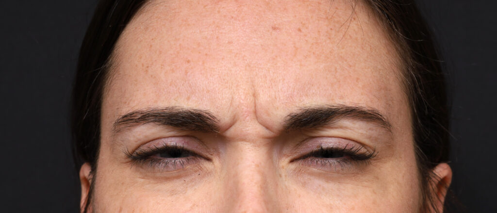 Plastic Surgery Before and After Pictures in Jacksonville, FL - Garcia Facial Plastic Surgery