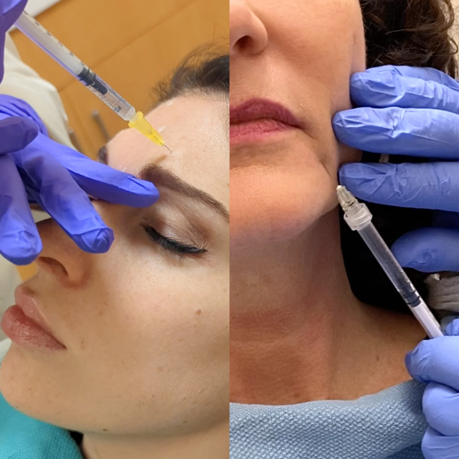 Botox & Fillers playlist cover